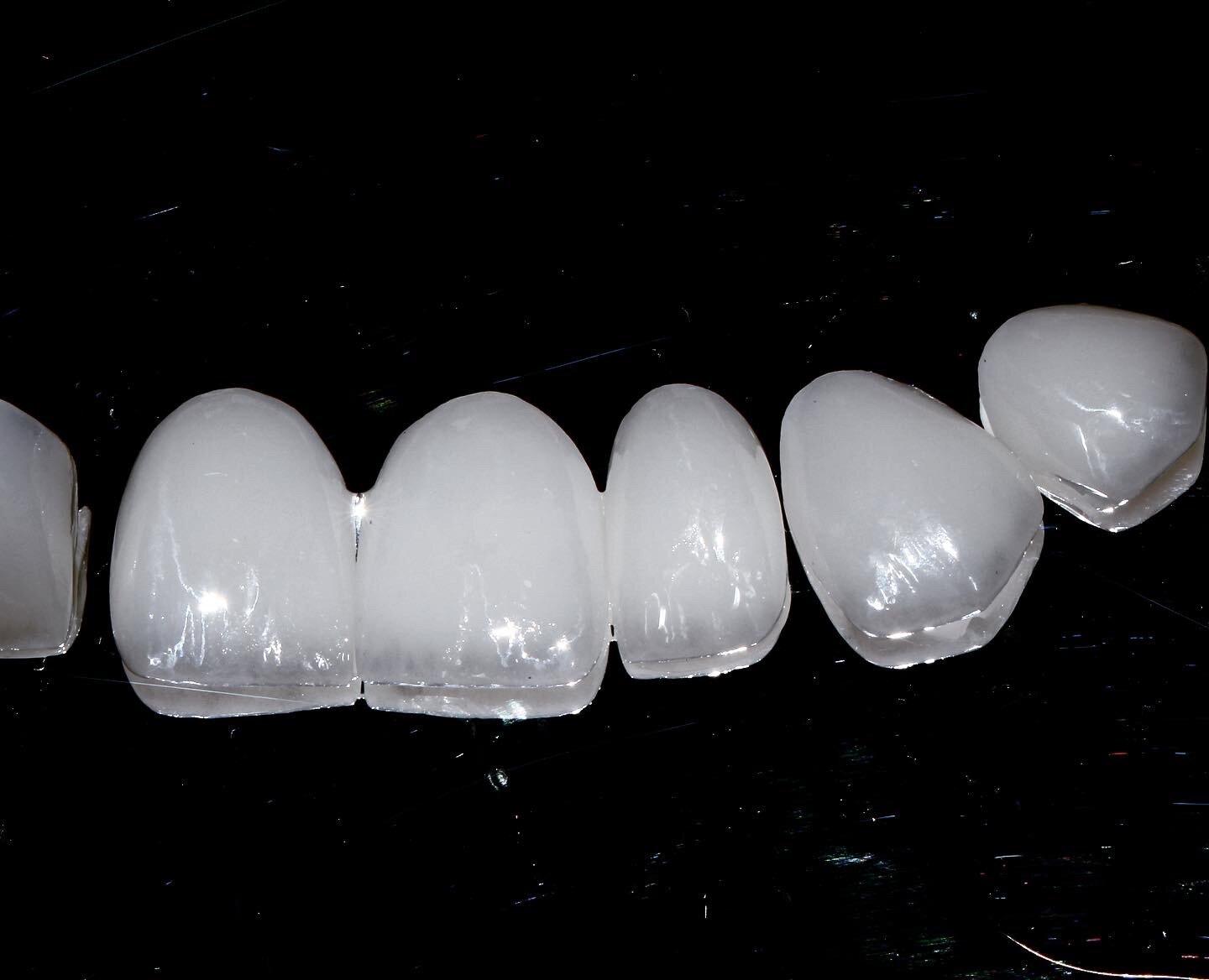 коронка из диоксида циркония в москве