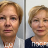фото от пользователя Наталья в отзыве о центре медицинской и аппаратной косметологии Сотис