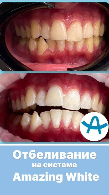 фотография работы Стоматологической клиники Альбус на улице Чернышевского
