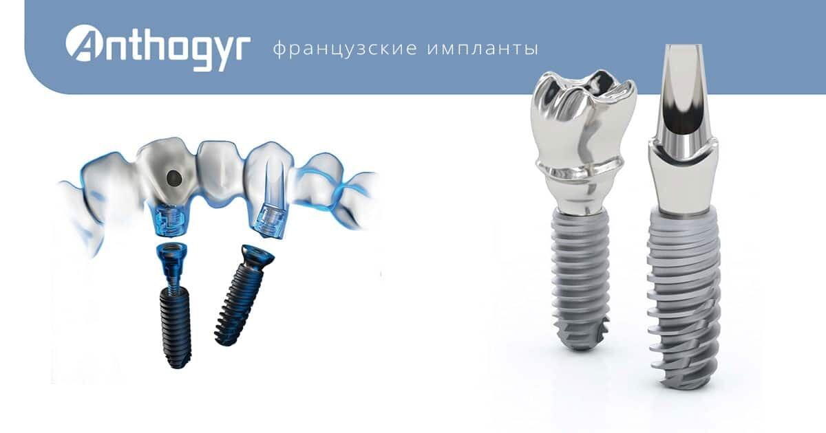 Импланты Anthogyr Томск Тютчева стоматология томск улыбка лазо