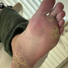 фото от пользователя Ирина  в отзыве о центре подологии Podo_clinik_msk