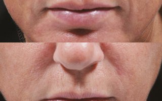 фотография работы врача Анжелики Викторовны Хешы