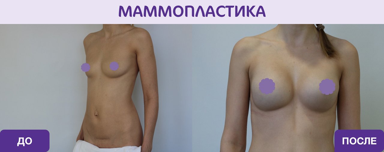 фотография работы Клинического госпиталя MD Group на Севастопольском проспекте