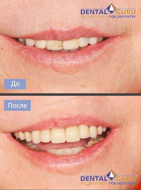 фотография работы Клиники Медалье