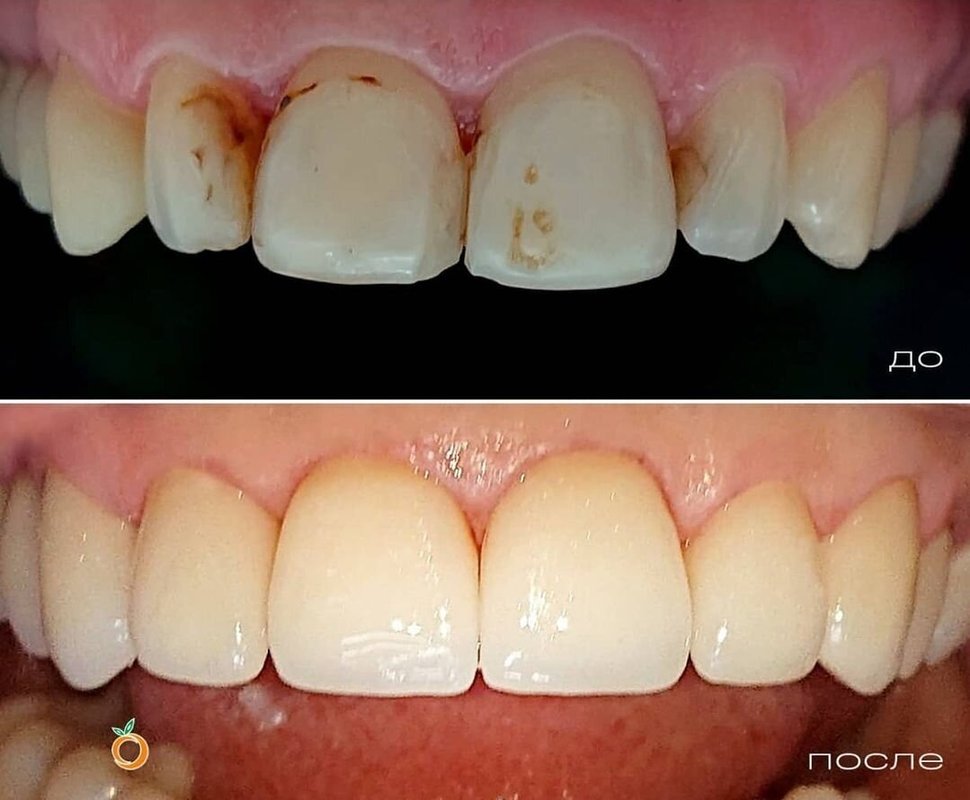 фотография работы Стоматологической клиники ОранжДент на улице Виллима Фермора