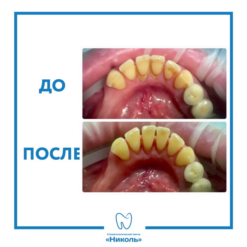 фотография работы Стоматологии Николь у метро Беговая