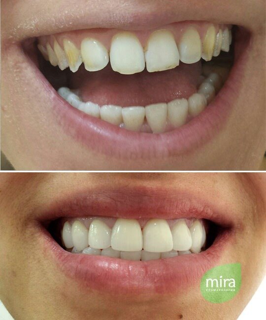 фотография работы Премиального центра стоматологии Mira на улице Партизана Железняка
