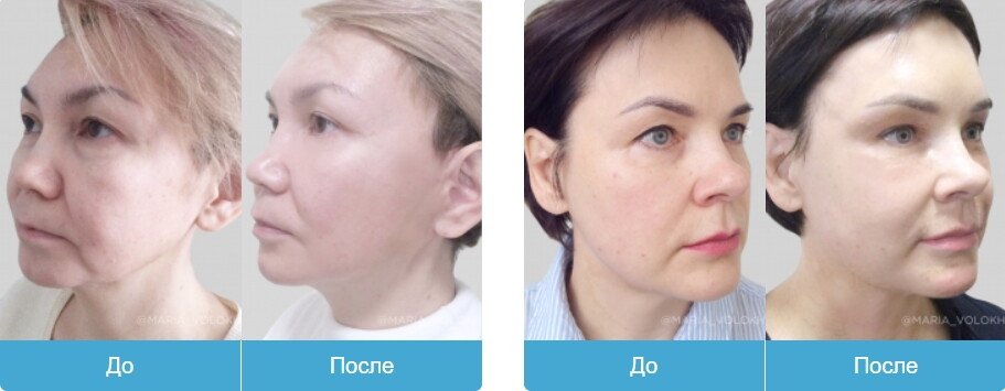 фотография работы Клиники эстетической медицины DEGA в Невском районе
