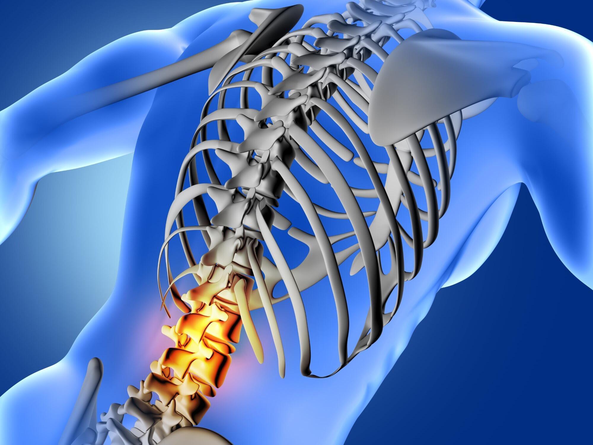 Позвоночник человека. Нестабильность l2 позвонка. Нестабильность поясничного отдела позвоночника. Нестабильность сегментов позвоночника. Лишний вес и позвоночник.