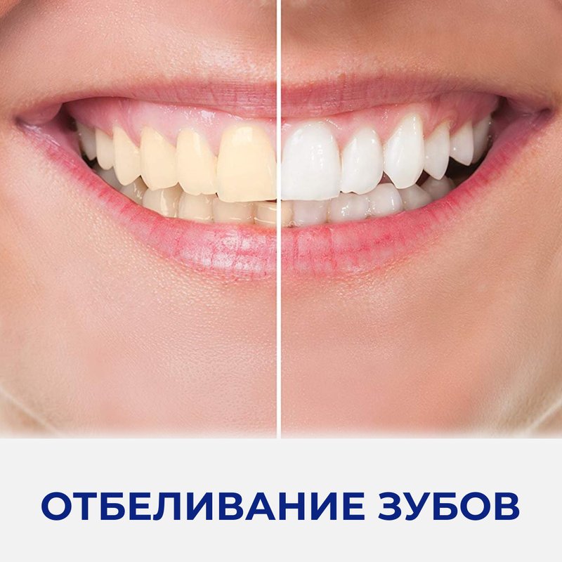 Зубы в разные стороны