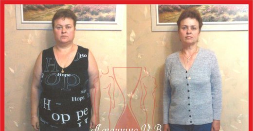 Городская октябрьская больница самарской области