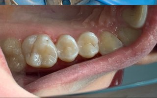 фотография работы врача Варвары Геннадьевны Халтуриной