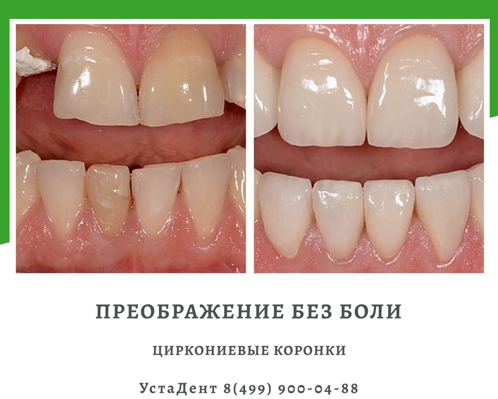фотография работы Стоматологии УстаДент на метро Яхромская